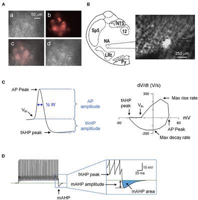 Secondhand Smoke Decreased Excitability and Altered Action Potential Characteristics of Cardiac Vagal Neurons in Mice